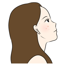 デリケートな悩み